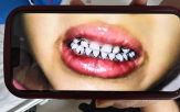 검사,유치원,당국,혈중,농도