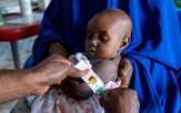 나이지리아,영양실조,아동