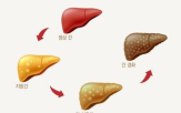 위험,예측,간질환,간경변,정확도