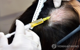 탈모,환자,남성,전체