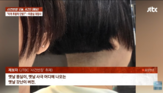 원장,머리,시술,마음