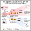 스트레스,어린,시절,생쥐,연구,변화