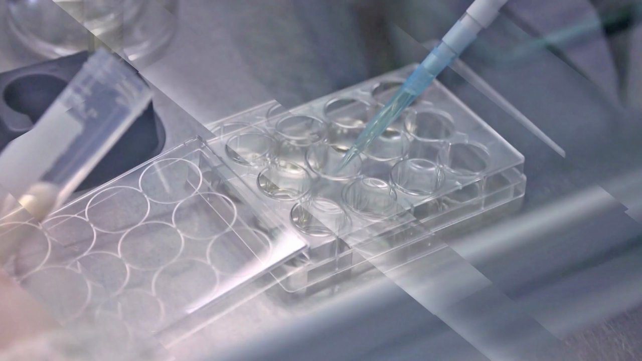 수액 더 비싸진다...제약사 사업도 '먹구름' [바이탈] - 뉴스 썸네일 이미지