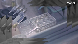 치료제,기전,알츠하이머,바이오텍,임상,가지