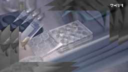 제약사,콜레스테롤,치료제,신약,이상지질혈증,시장,후보물질