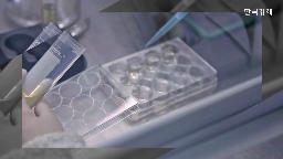 헬스케어,디지털,기업,병원,기술,환자,의료,사업,혈압,LG