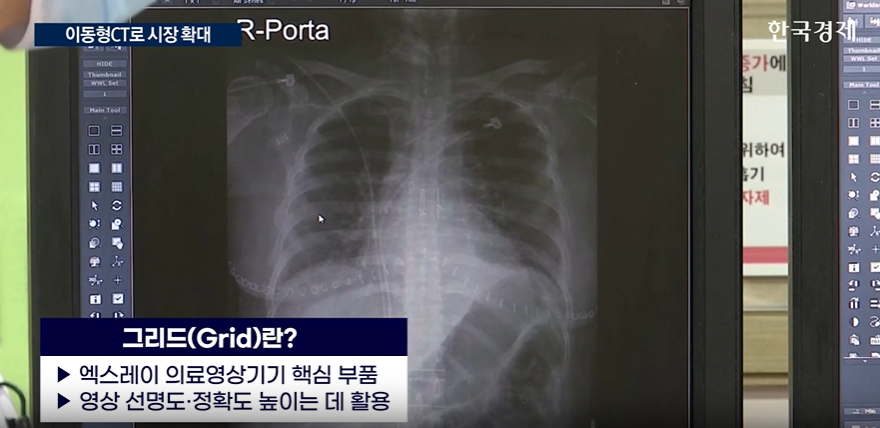 제이피아이헬스케어,그리드,예정,공모,엑스레이,우려,의료