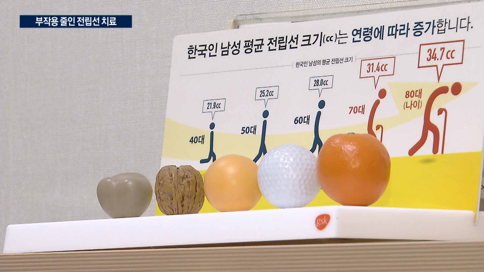 수술,전립선,조직,치료,부작용,제거,환자