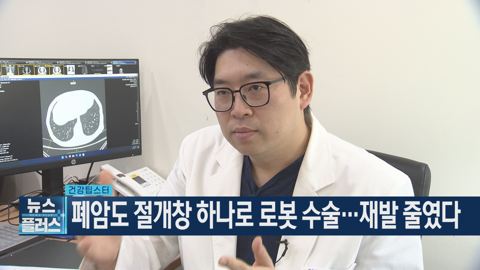 수술,로봇,폐암,단일공,환자