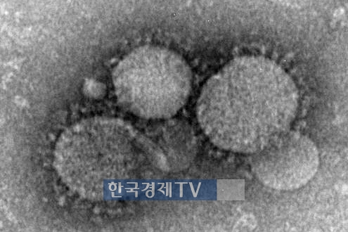 중국 간 메르스 의심자 메르스 바이러스 확진 현미경에서 관찰된 중동호흡기증후군 바이러스의 모습