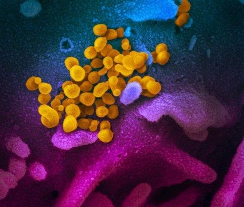 코로나 바이러스의 전자현미경 영상 (사진=미 NIH 국립 알레르기 감염병 연구소)