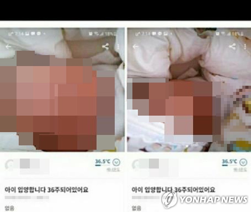 36주 된 아이를 거래하겠다고 올린 글 (사진=연합뉴스) 