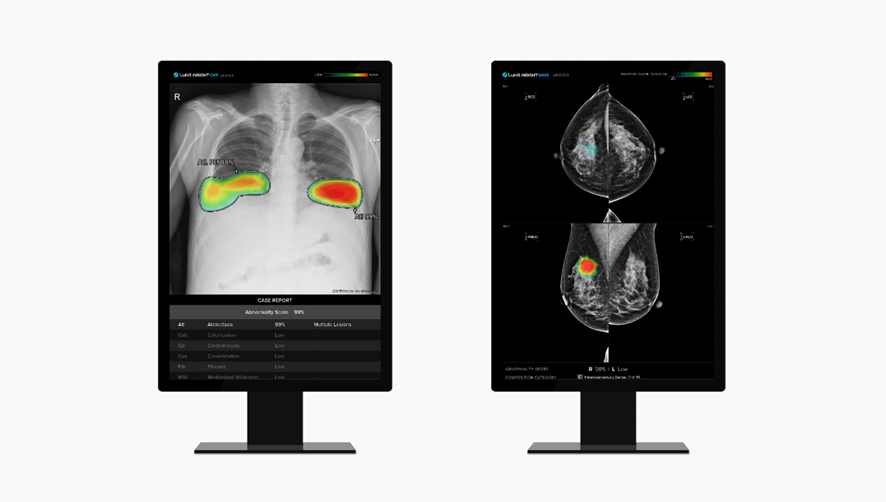 (왼쪽부터) 흉부 엑스레이 영상분석 솔루션 `루닛 인사이트 CXR`과 유방촬영술 영상분석 솔루션 `루닛 인사이트 MMG`. (사진제공=루닛)