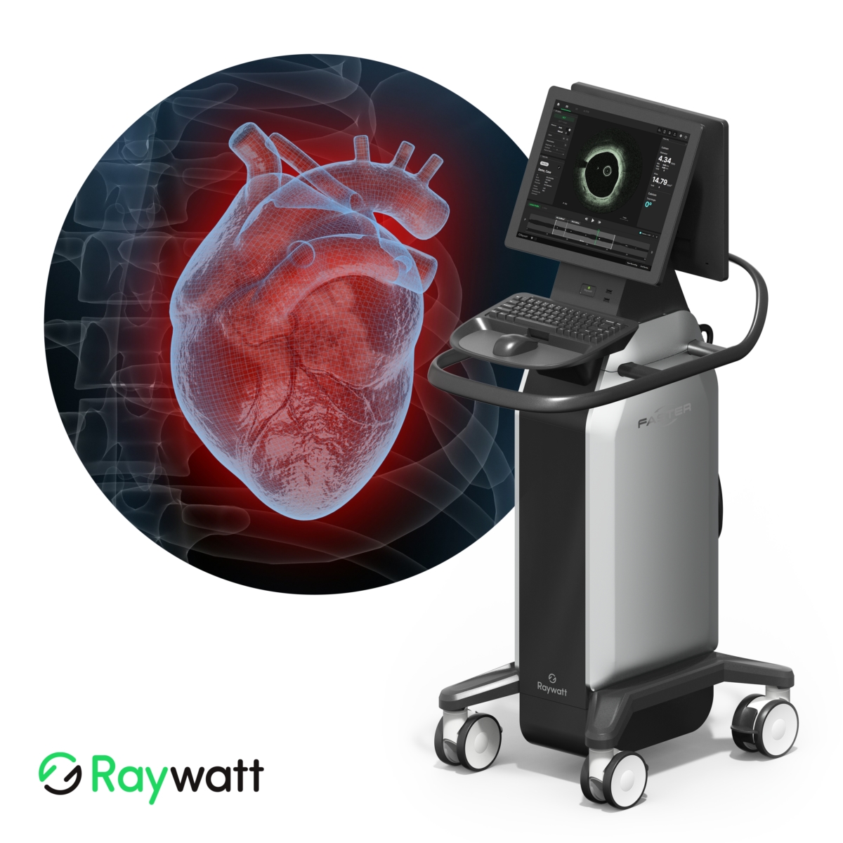 레이와트, '조영제 없는 OCT'로 85억원 투자 유치 - 뉴스 썸네일 이미지